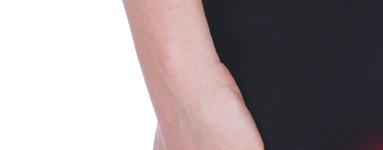 Nad hemoroide povsem naravno!